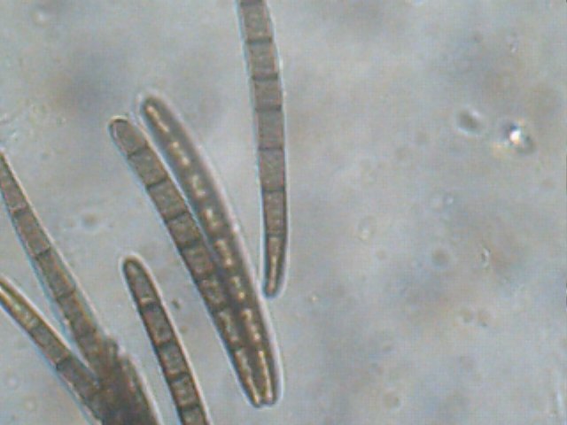 macrostoma