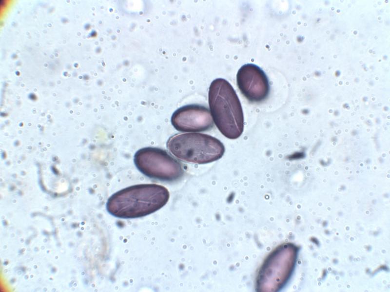 macrostoma
