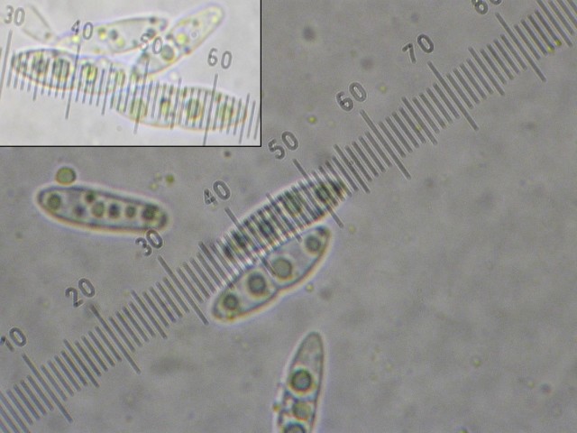 macrostoma