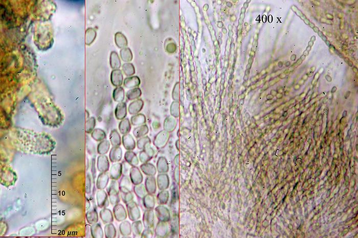 macrostoma