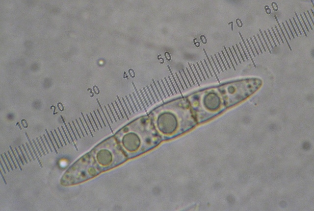 macrostoma