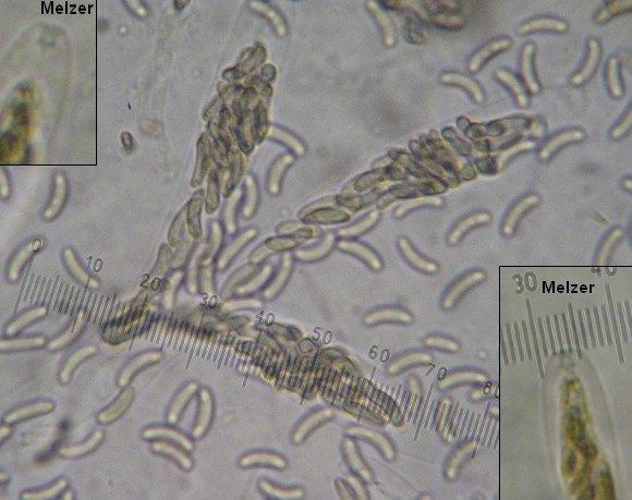 macrostoma
