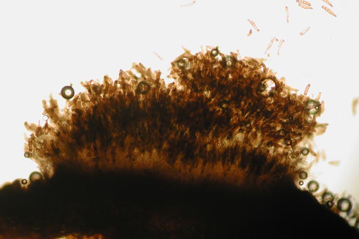 macrostoma
