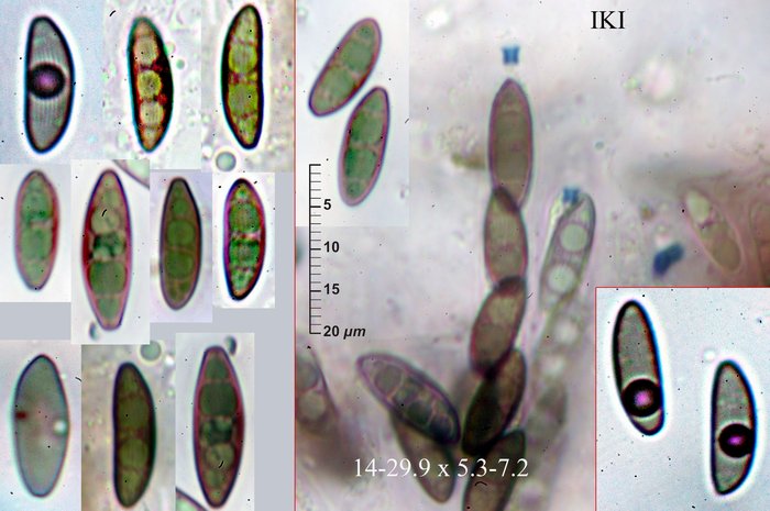 macrostoma