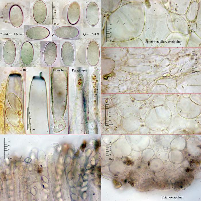 macrostoma