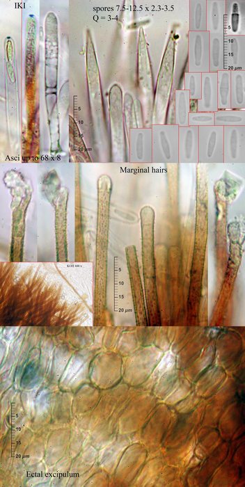 macrostoma