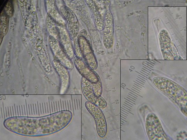 macrostoma