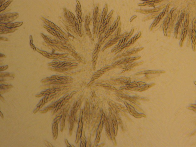 macrostoma