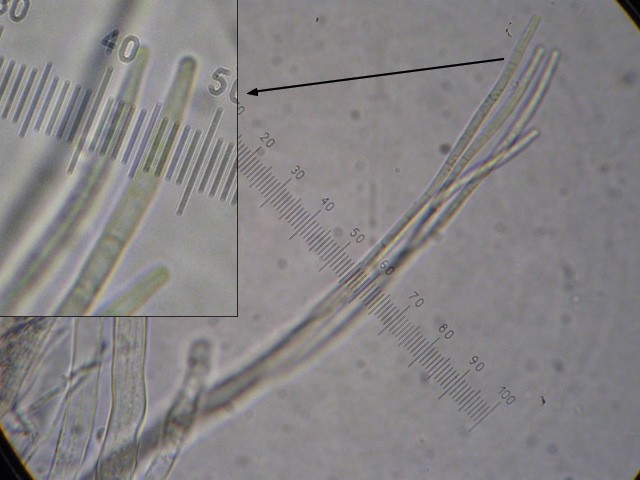 macrostoma