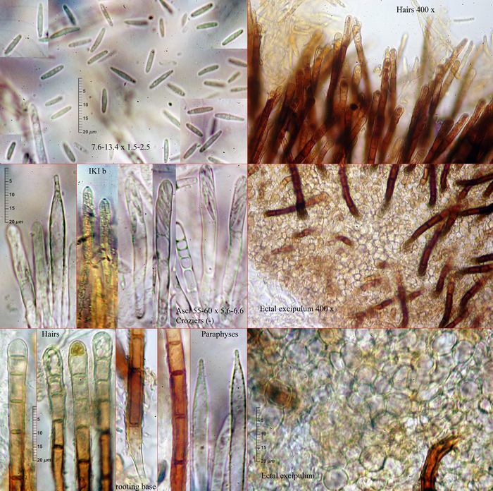 macrostoma