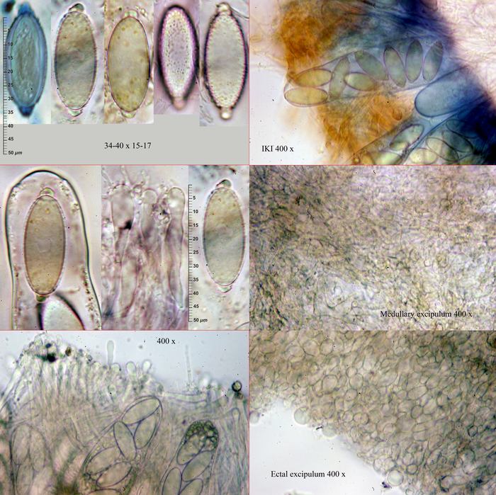 macrostoma