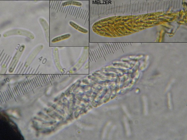 macrostoma