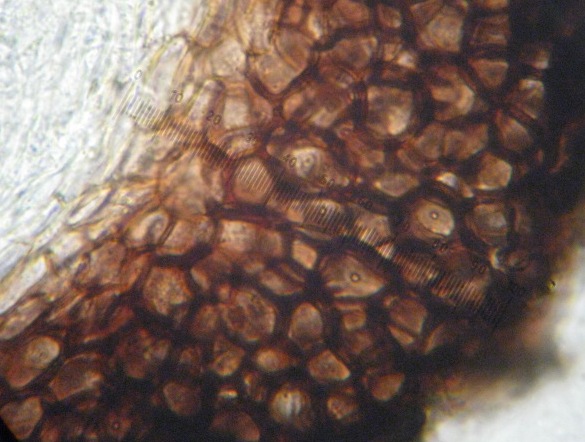 macrostoma
