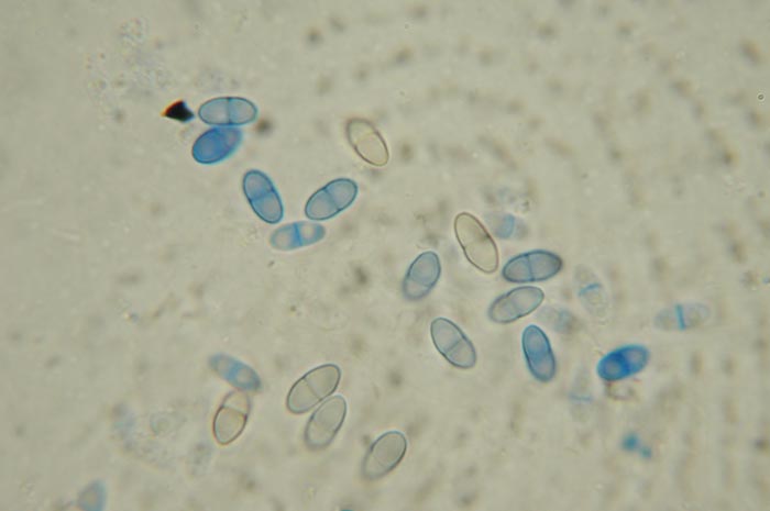 macrostoma