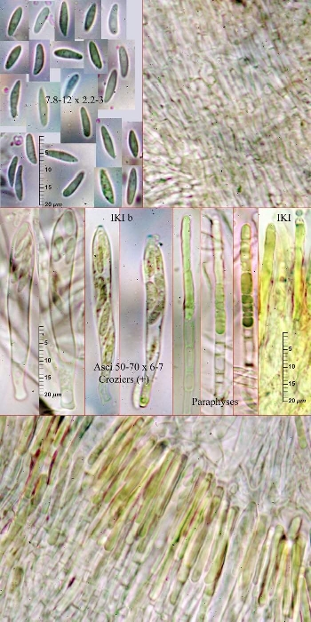 macrostoma