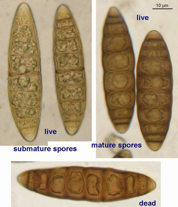 macrostoma