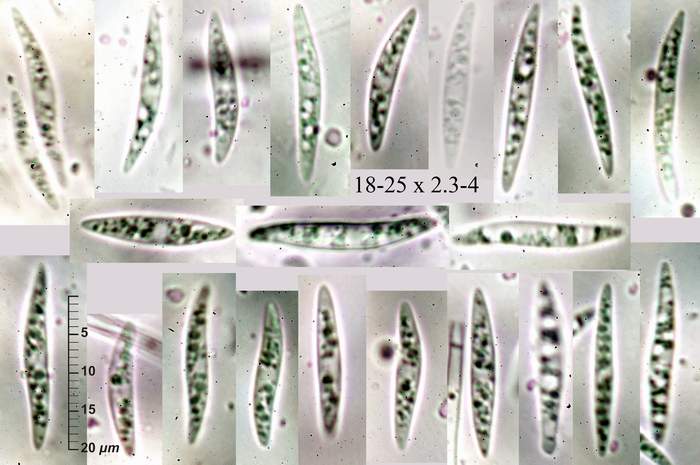macrostoma