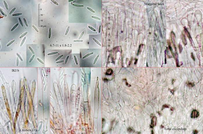 macrostoma