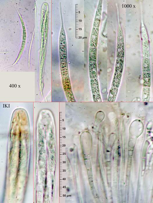 macrostoma
