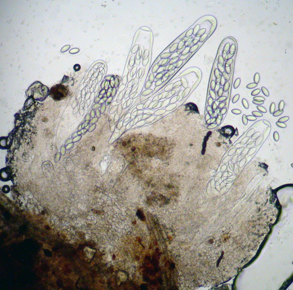 macrostoma