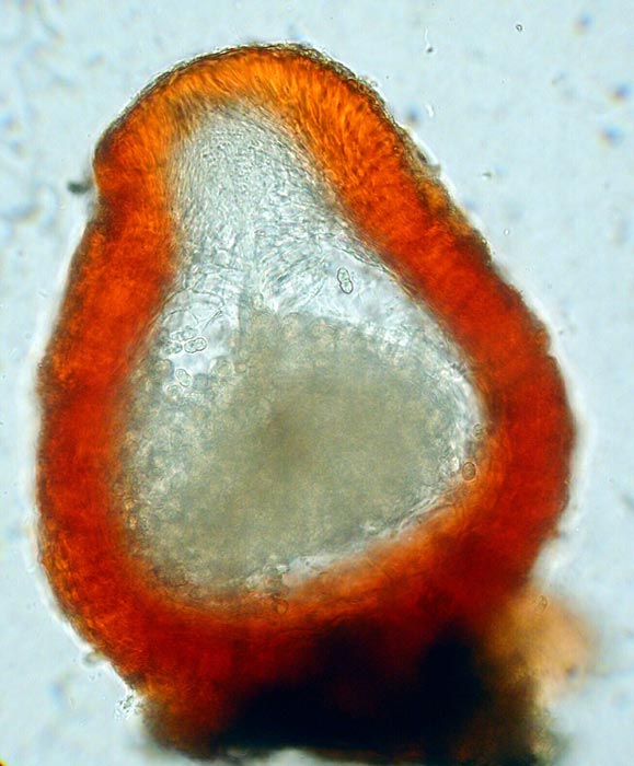 macrostoma