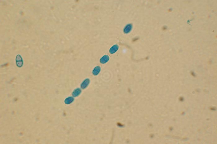 macrostoma
