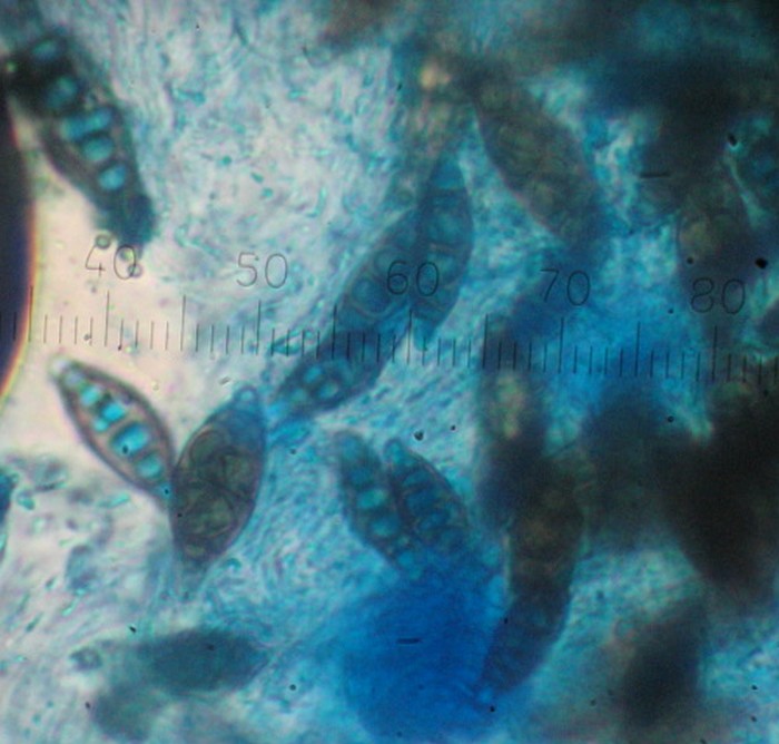 macrostoma