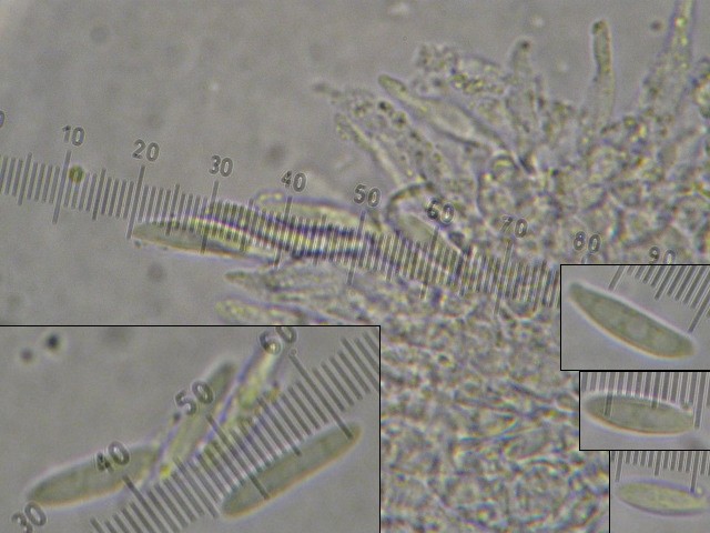 macrostoma