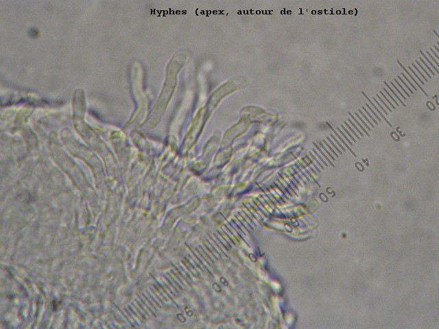 macrostoma