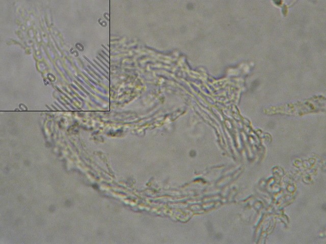 macrostoma