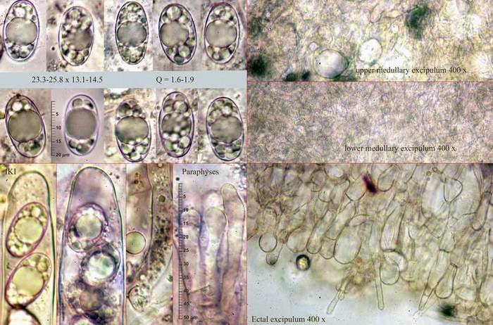 macrostoma