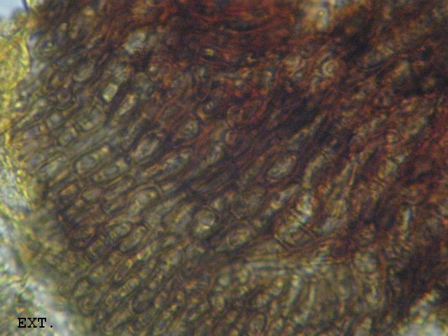 macrostoma