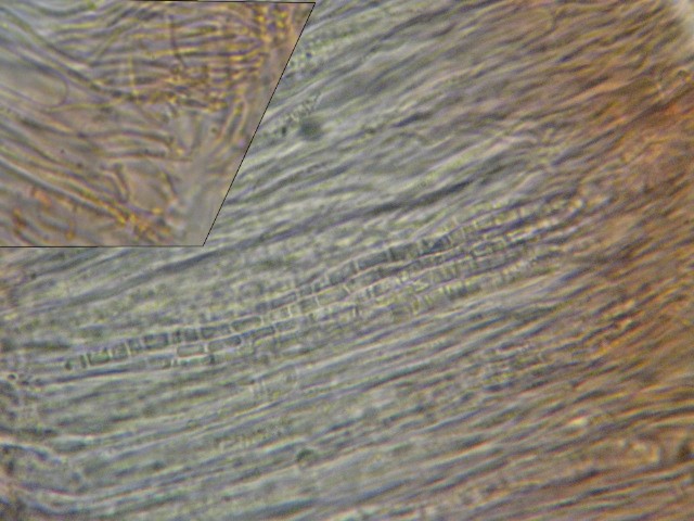 macrostoma