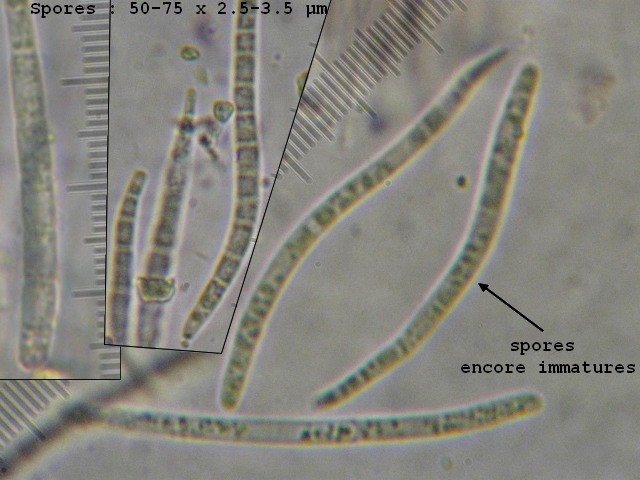 macrostoma
