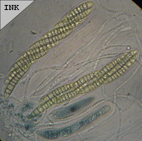 macrostoma