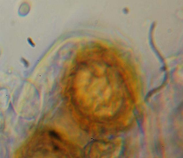macrostoma