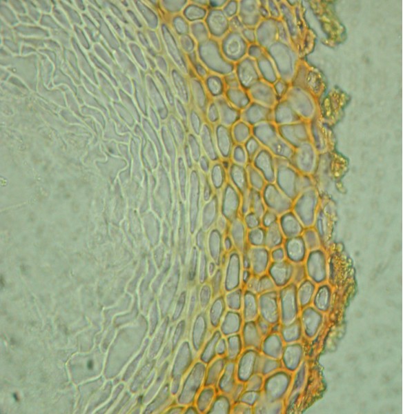 macrostoma