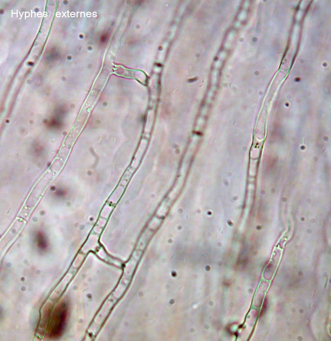 macrostoma