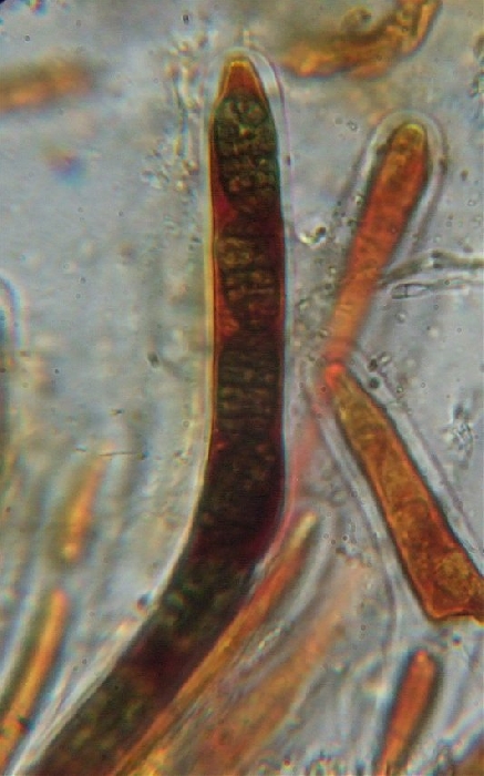 macrostoma
