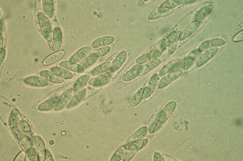 macrostoma
