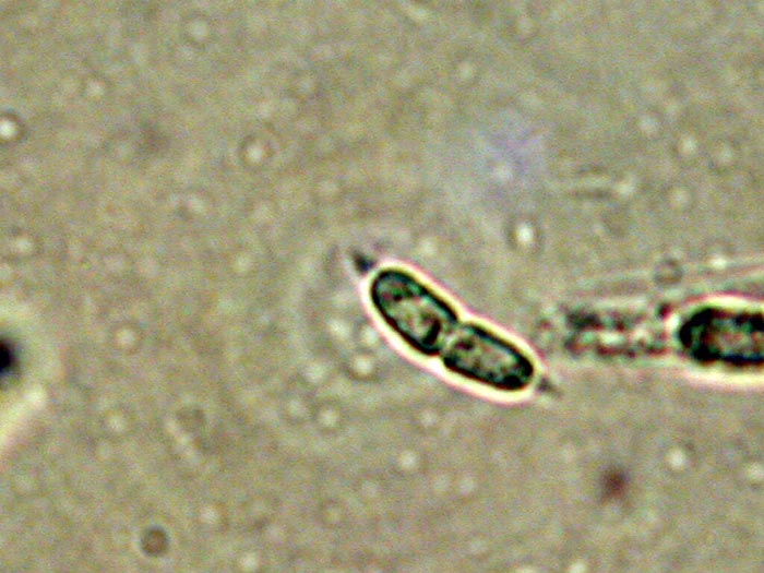 macrostoma