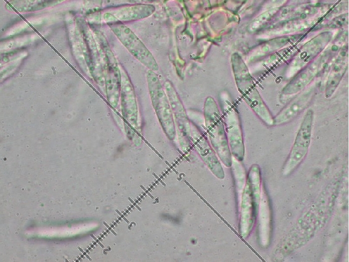 macrostoma