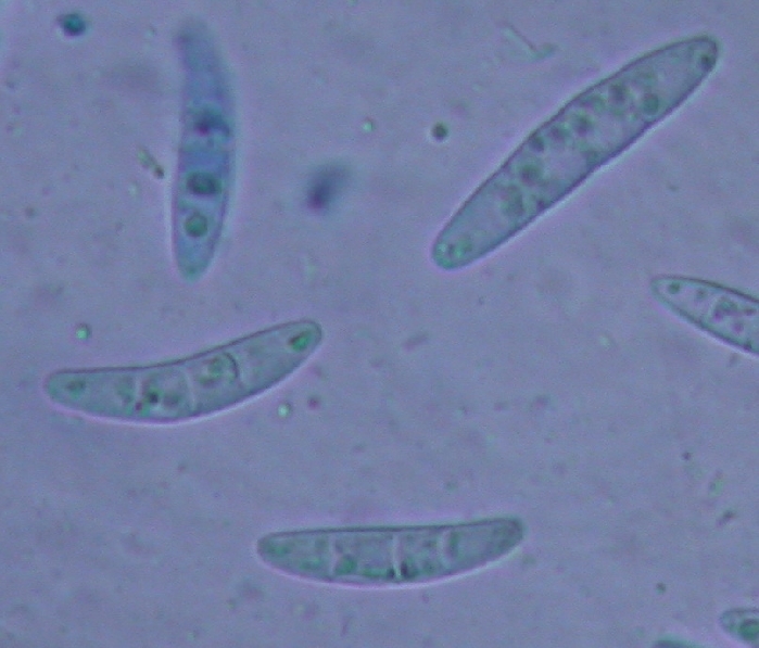 macrostoma