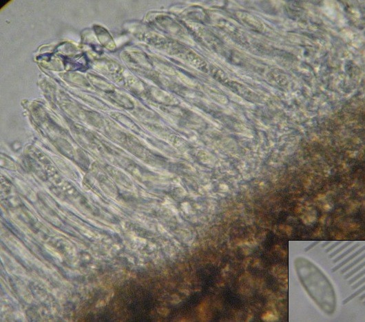 macrostoma