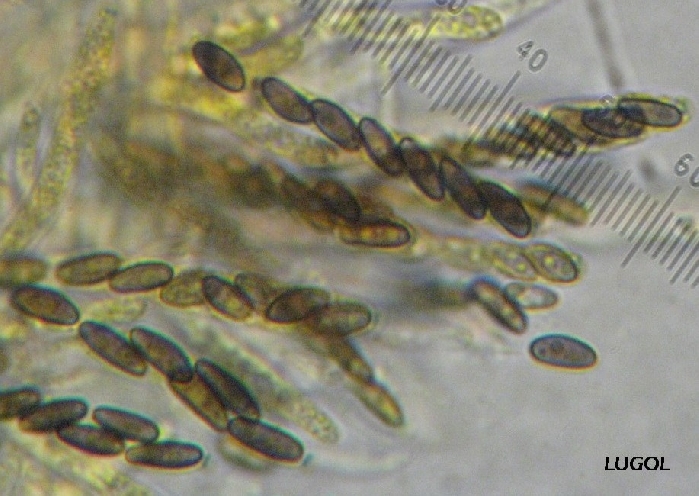 macrostoma