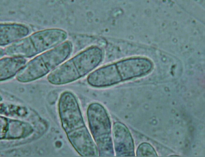 macrostoma