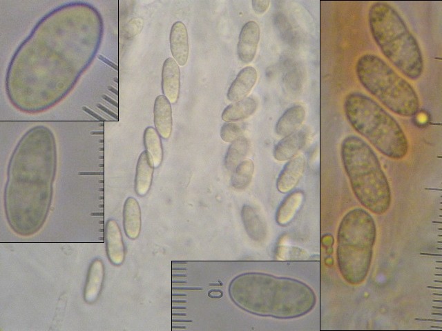 macrostoma