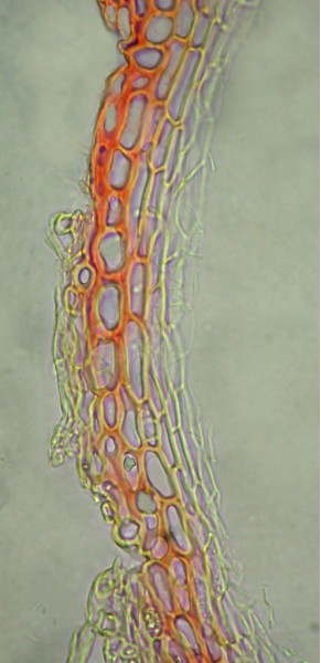 macrostoma