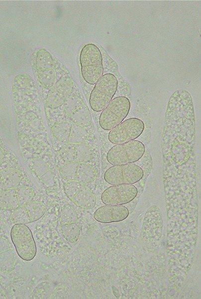 macrostoma