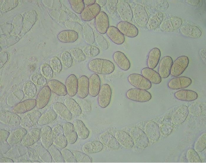 macrostoma